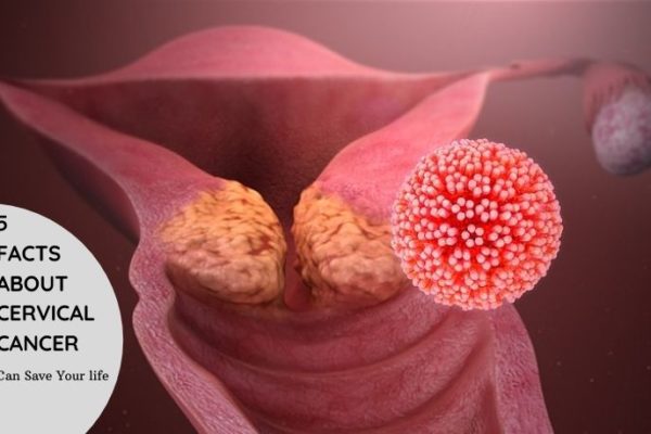 Cervical Cancer